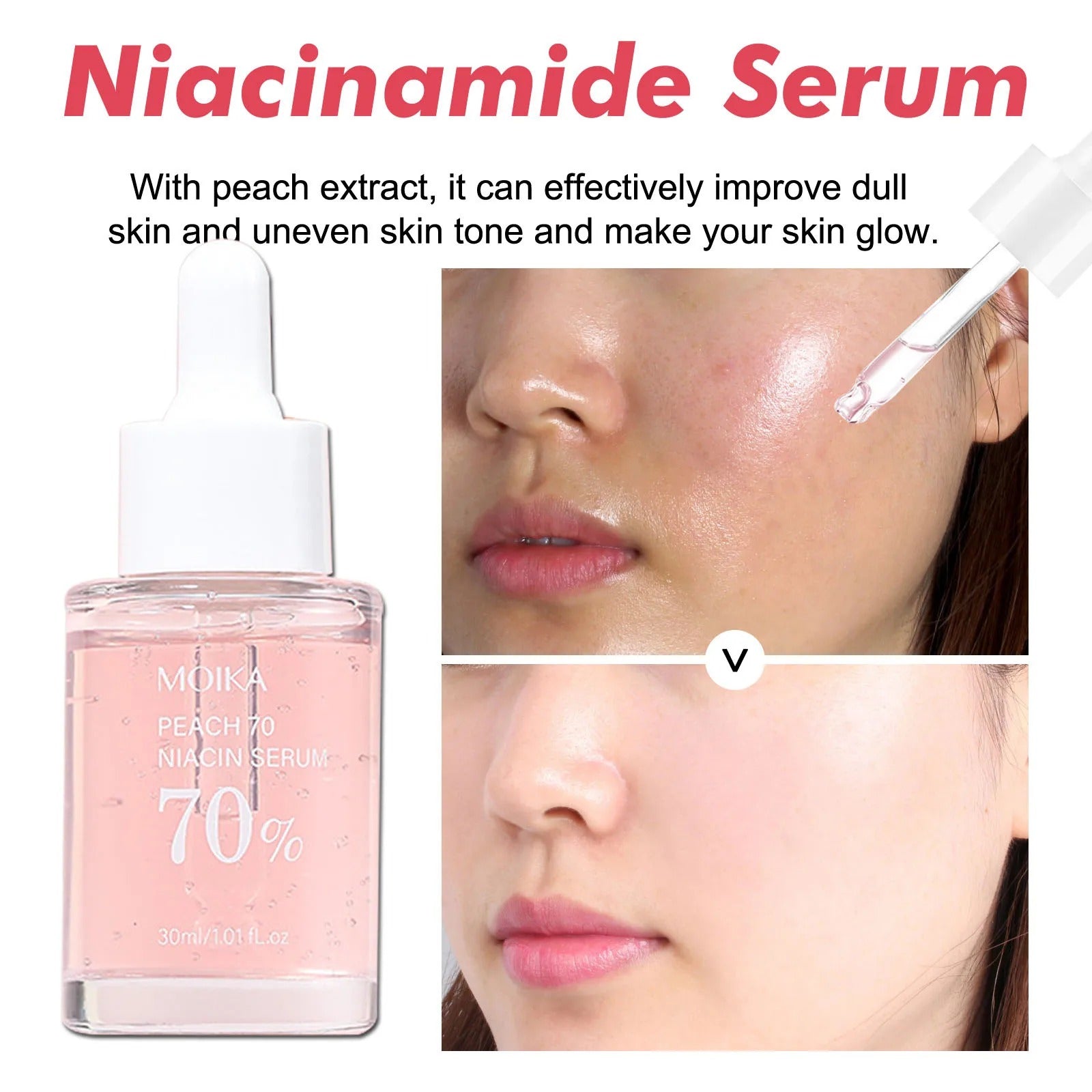 Niacinamide Serum Dark Spot Remover Fade Acne Marks